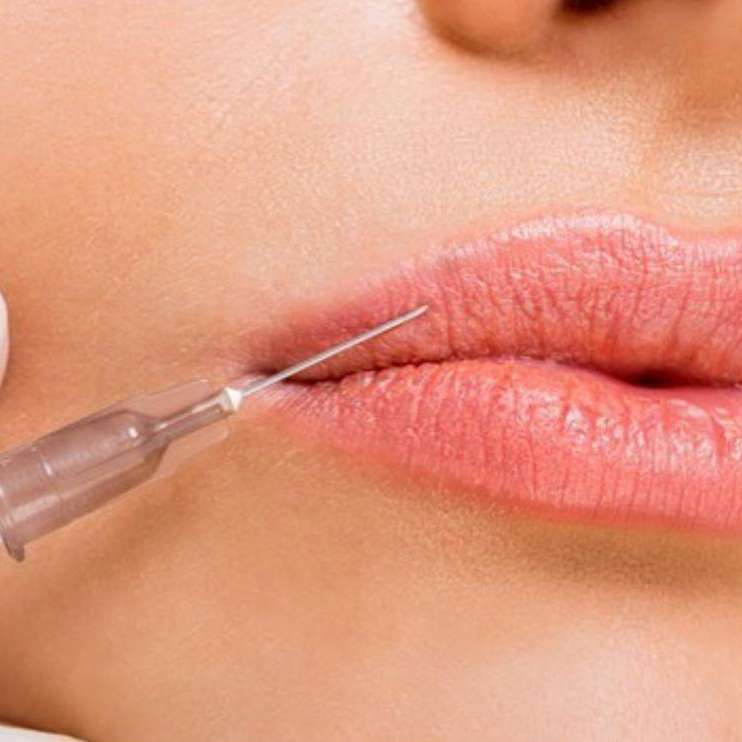 Filler-1-Roya-Beauty-Salon Filler-1-Roya-Beauty-Salon